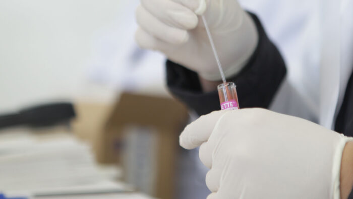 Campanha de prevenção às ISTs chega às USFs de Suzano neste mês