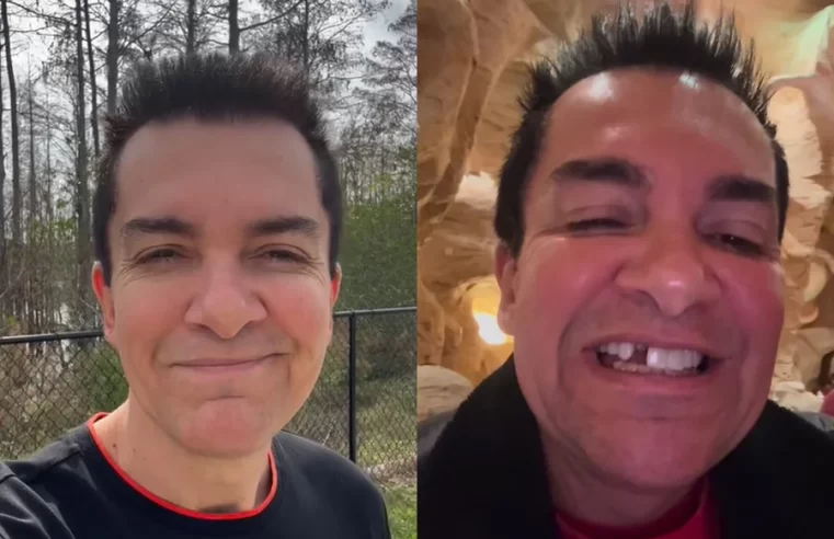 Regis Danese viraliza após perder dente durante viagem aos EUA