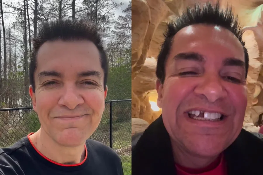Regis Danese viraliza após perder dente durante viagem aos EUA