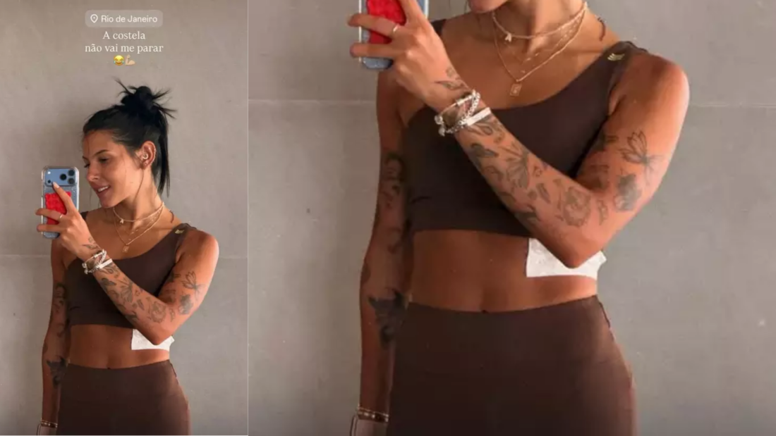 Ana Castela atualiza fãs após fratura na costela