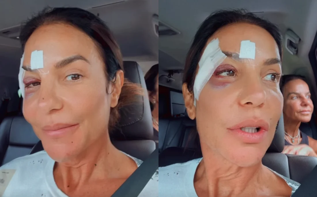 Ivete Sangalo recebe alta e tranquiliza fãs